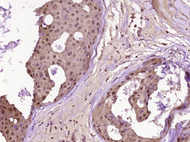 PARP1 Antibody in Immunohistochemistry (Paraffin) (IHC (P))