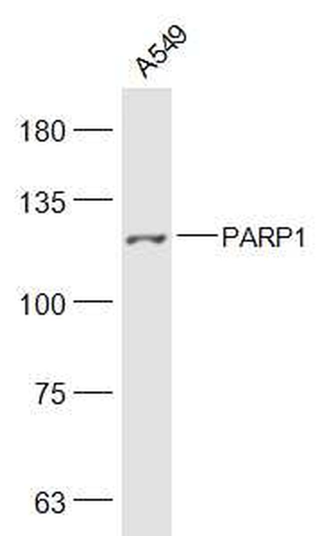 PARP1 Antibody in Western Blot (WB)