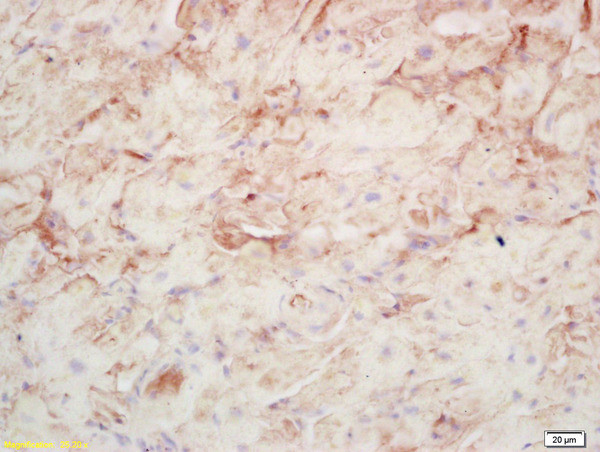 AMPD1 Antibody in Immunohistochemistry (Paraffin) (IHC (P))