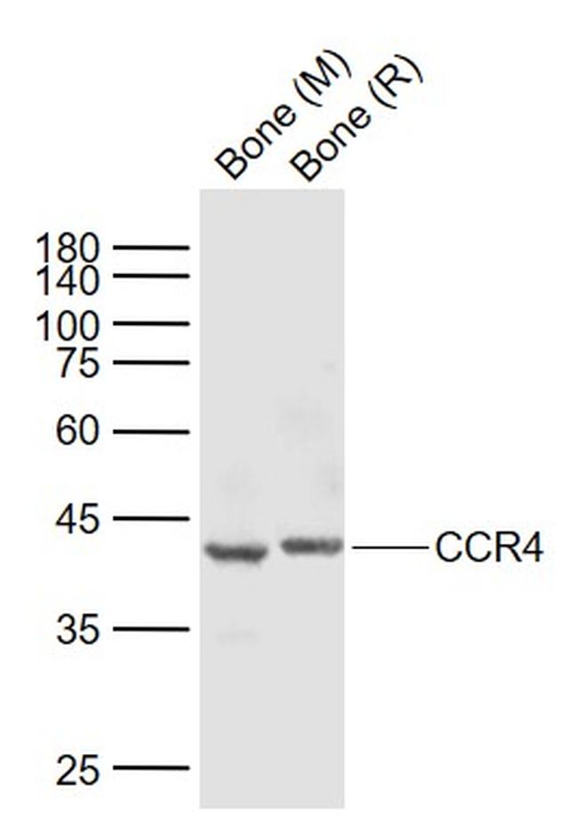 CCR4 Antibody in Western Blot (WB)