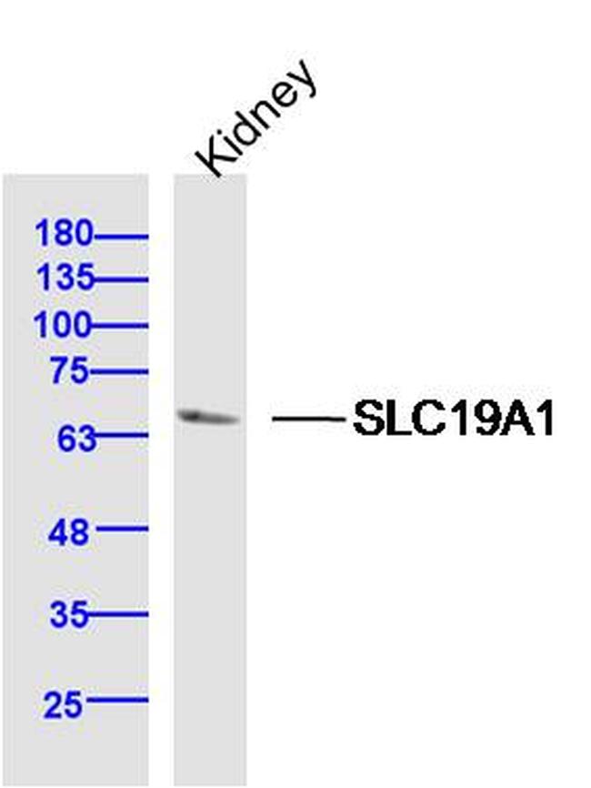 SLC19A1 Antibody in Western Blot (WB)