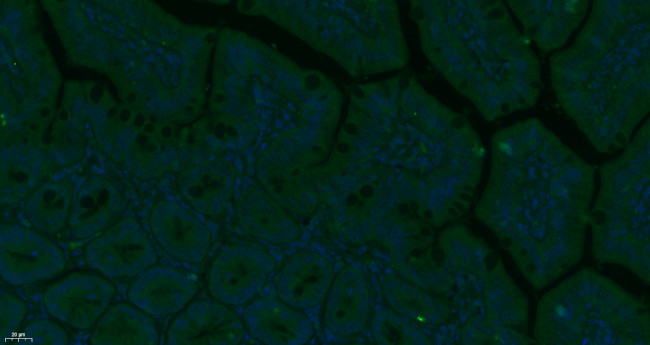 TEM1/CD248 Antibody in Immunohistochemistry (Paraffin) (IHC (P))