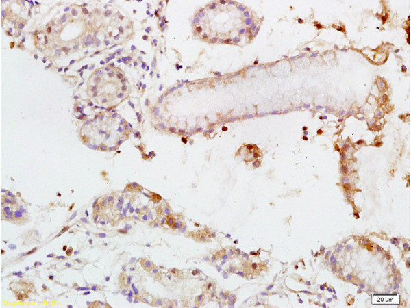 TEM1/CD248 Antibody in Immunohistochemistry (Paraffin) (IHC (P))