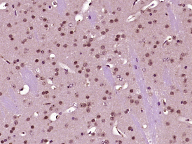 p66 alpha/GATAD2A Antibody in Immunohistochemistry (Paraffin) (IHC (P))