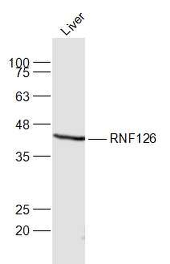 RNF126 Antibody in Western Blot (WB)