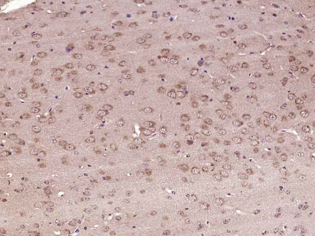 5HT4 Receptor Antibody in Immunohistochemistry (Paraffin) (IHC (P))