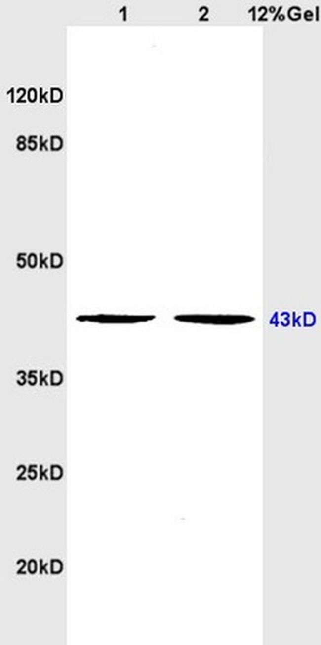 5HT4 Receptor Antibody in Western Blot (WB)