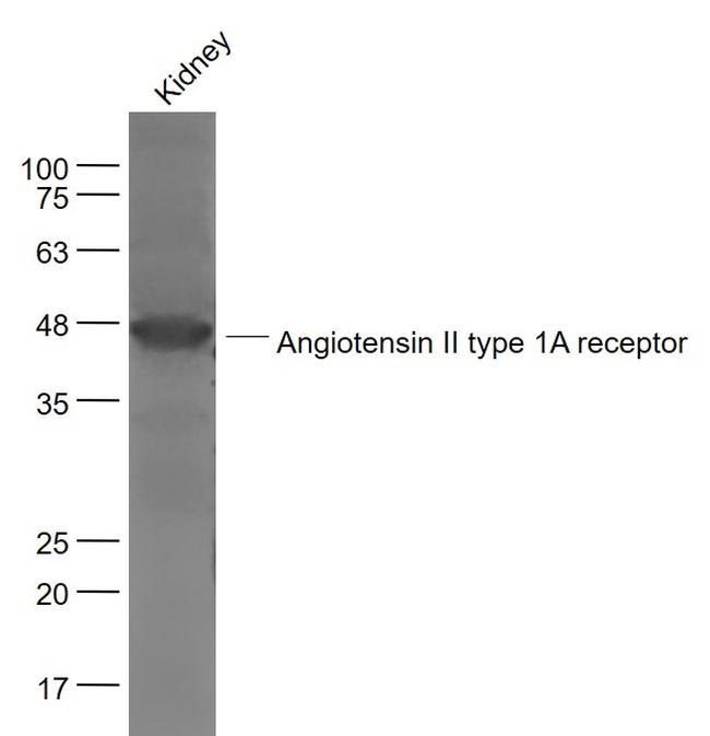 Angiotensin 2 type 1A receptor Antibody in Western Blot (WB)