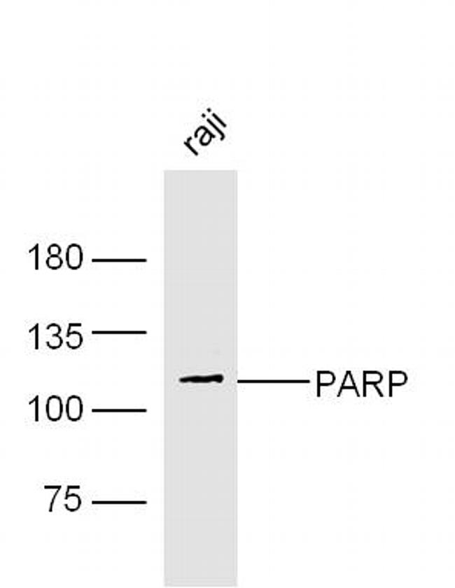 PARP1 Antibody in Western Blot (WB)