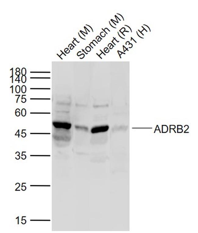 ADRB2 Antibody in Western Blot (WB)