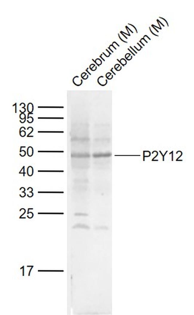 P2Y12 Antibody in Western Blot (WB)