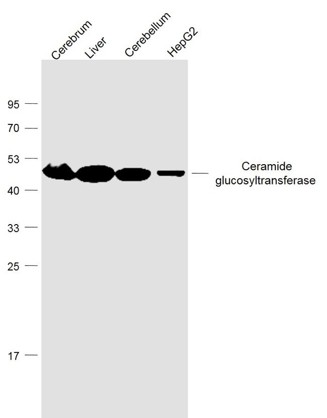 Ceramide glucosyltransferase Antibody in Western Blot (WB)