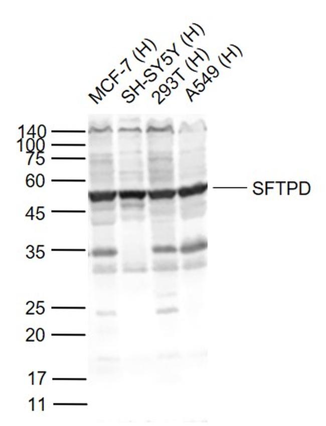 SFTPD Antibody in Western Blot (WB)