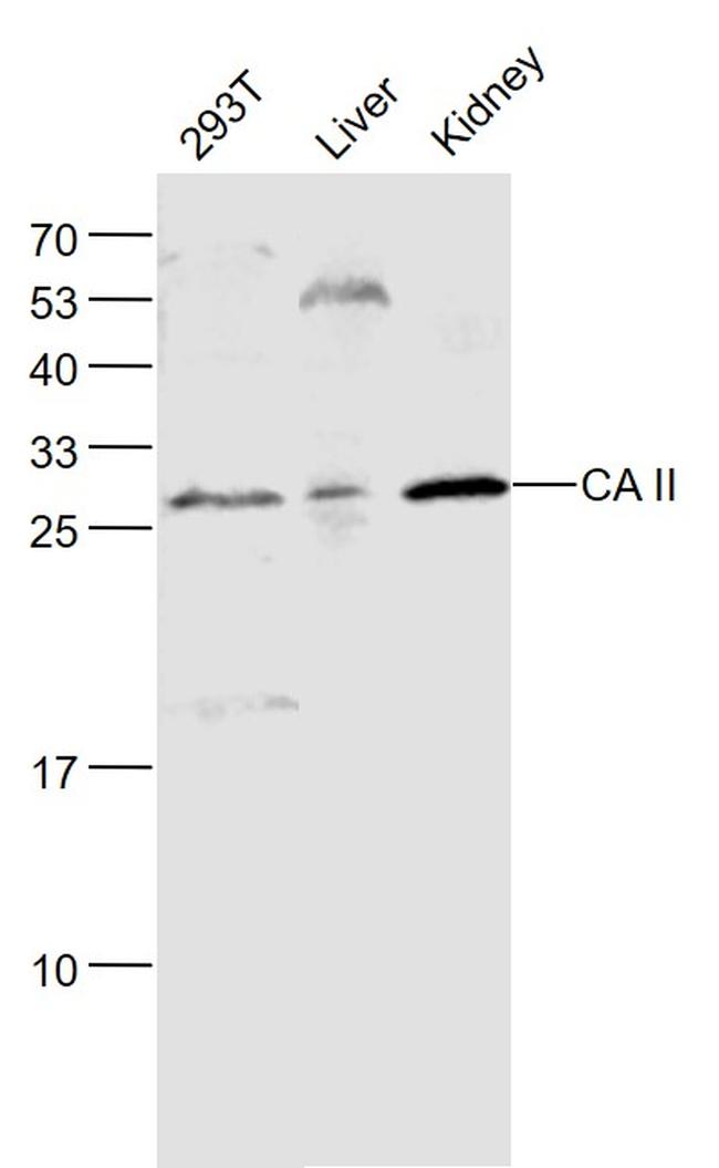 CA II Antibody in Western Blot (WB)