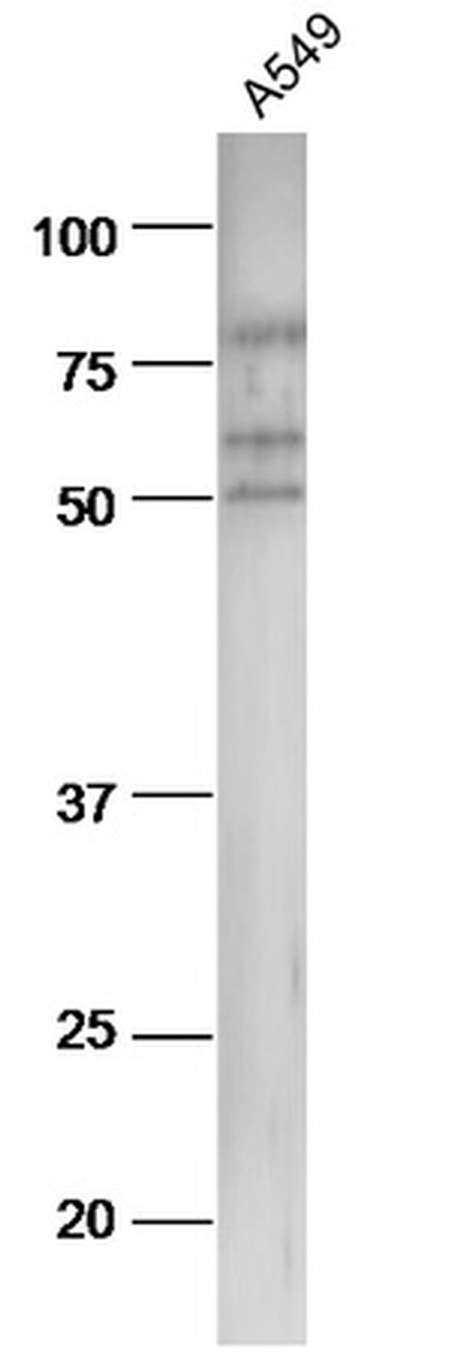 pan-Cytokeratin Antibody in Western Blot (WB)