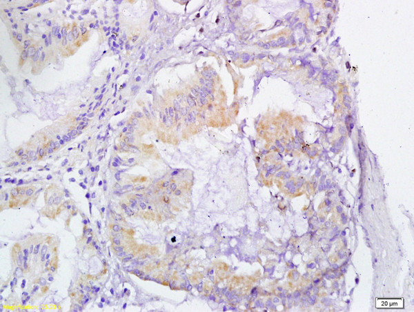 VEGFR3 Antibody in Immunohistochemistry (Paraffin) (IHC (P))