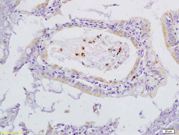 VEGFR3 Antibody in Immunohistochemistry (Paraffin) (IHC (P))