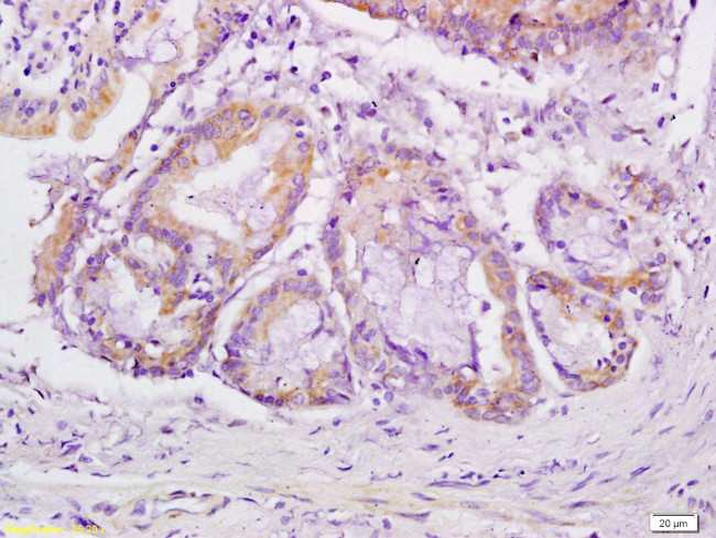 VEGFR3 Antibody in Immunohistochemistry (Paraffin) (IHC (P))