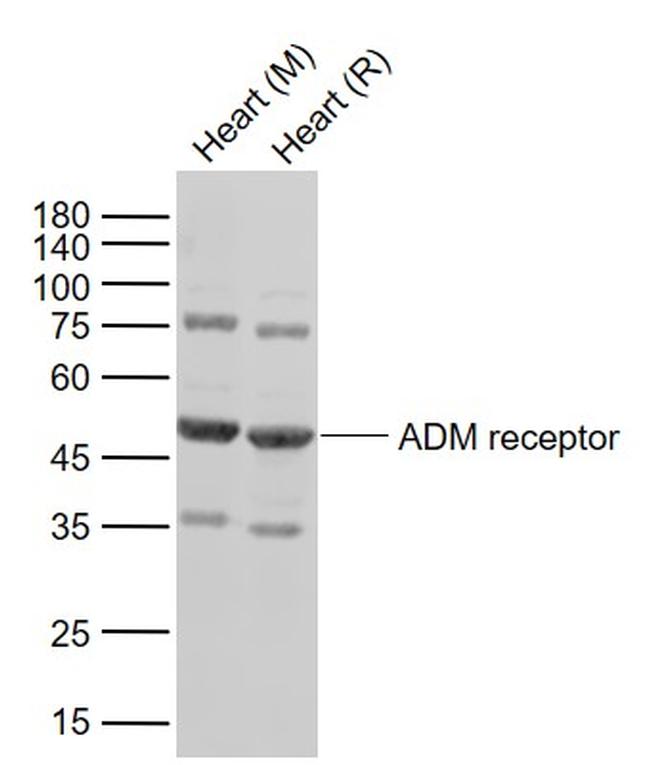 ADM receptor Antibody in Western Blot (WB)