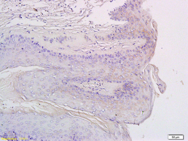 CXCR3/CD183 Antibody in Immunohistochemistry (Paraffin) (IHC (P))