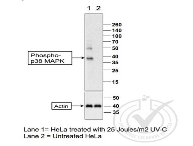 Phospho-p38 MAPK (Thr180, Tyr182) Antibody in Western Blot (WB)