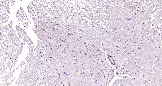 IL-1RA Antibody in Immunohistochemistry (Paraffin) (IHC (P))