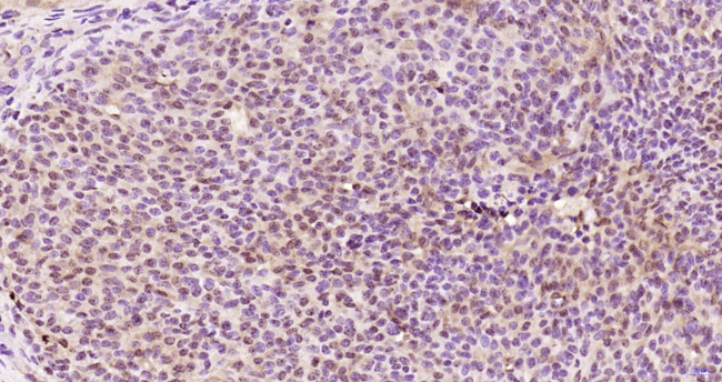 KRG2/DDX11 Antibody in Immunohistochemistry (Paraffin) (IHC (P))