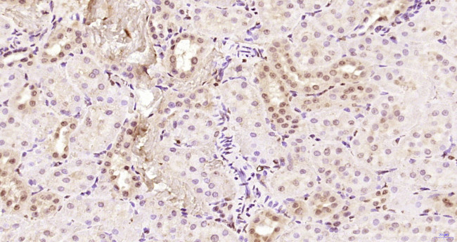 KRG2/DDX11 Antibody in Immunohistochemistry (Paraffin) (IHC (P))