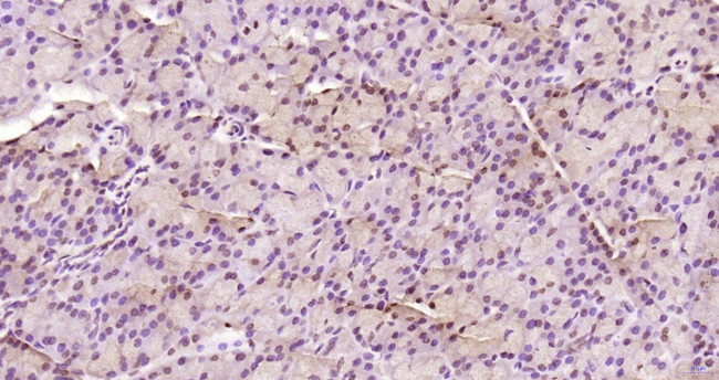 KRG2/DDX11 Antibody in Immunohistochemistry (Paraffin) (IHC (P))