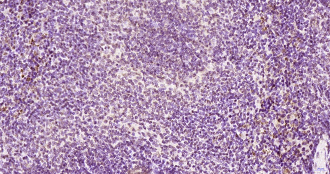 KRG2/DDX11 Antibody in Immunohistochemistry (Paraffin) (IHC (P))