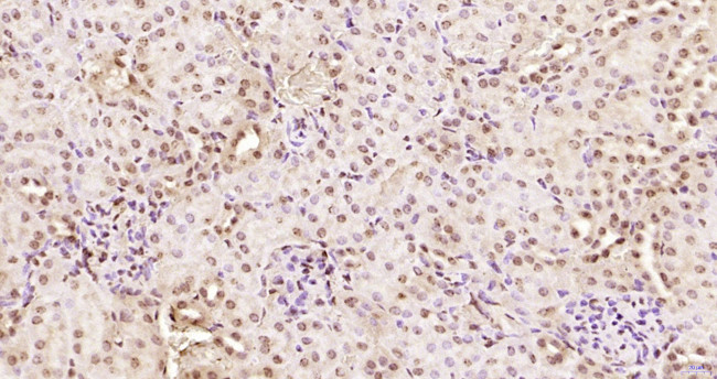 KRG2/DDX11 Antibody in Immunohistochemistry (Paraffin) (IHC (P))