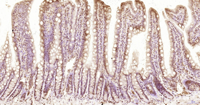 KRG2/DDX11 Antibody in Immunohistochemistry (Paraffin) (IHC (P))