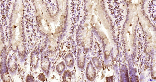 KRG2/DDX11 Antibody in Immunohistochemistry (Paraffin) (IHC (P))