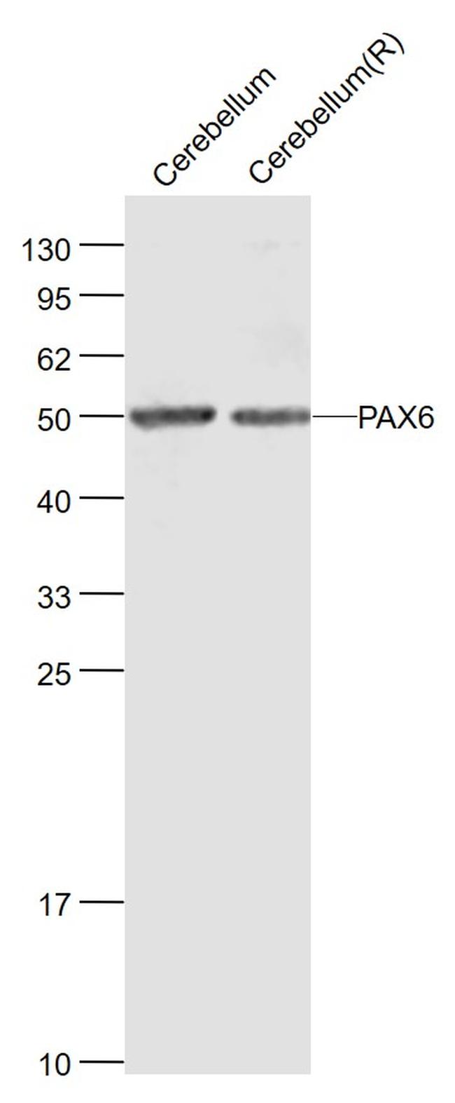 PAX6 Antibody in Western Blot (WB)