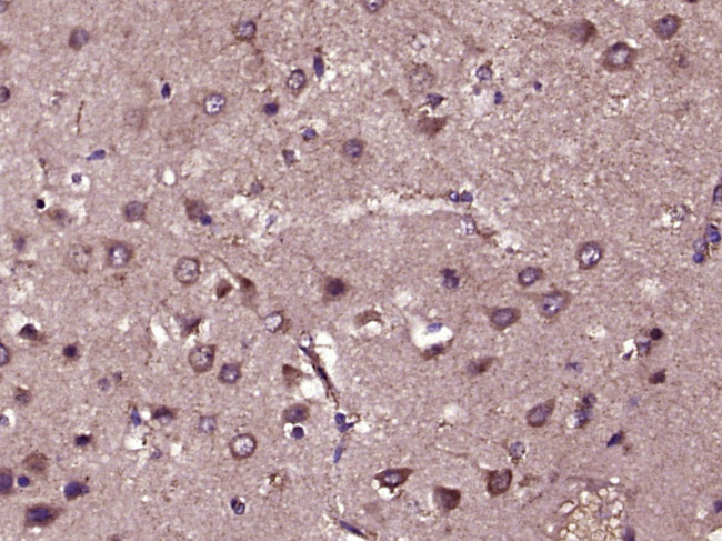 bFGF Antibody in Immunohistochemistry (Paraffin) (IHC (P))