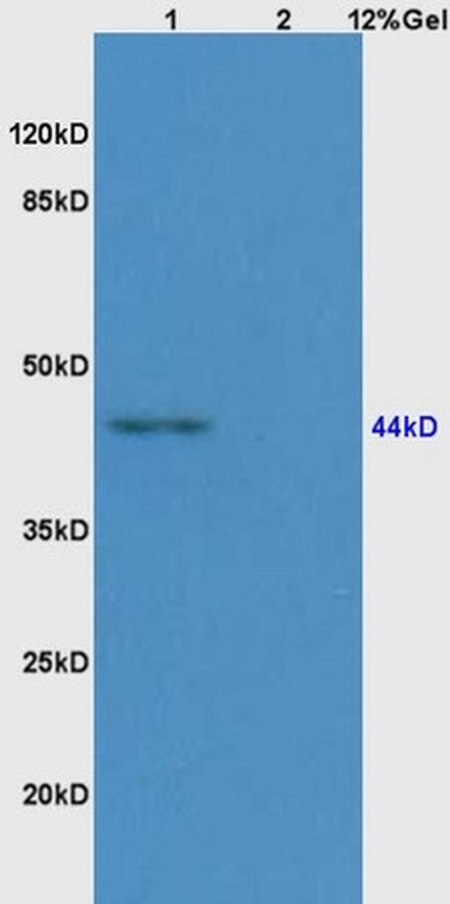 CD209 Antibody in Western Blot (WB)