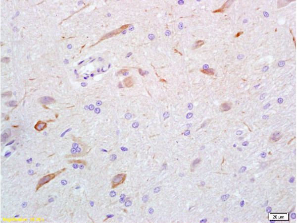 GABA Antibody in Immunohistochemistry (Paraffin) (IHC (P))