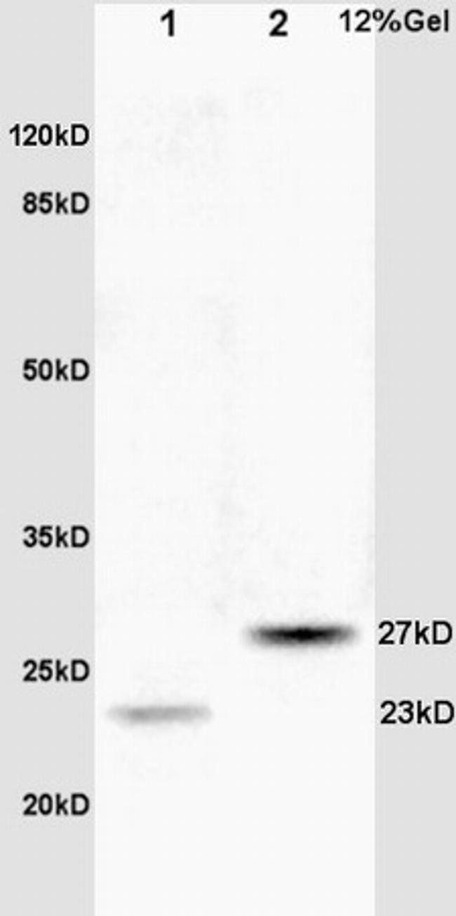 CPSF4 Antibody in Western Blot (WB)