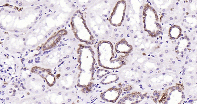 PAR-2 Antibody in Immunohistochemistry (Paraffin) (IHC (P))