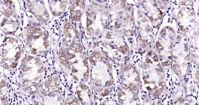 PAR-2 Antibody in Immunohistochemistry (Paraffin) (IHC (P))