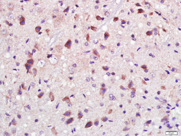 PAK1 Antibody in Immunohistochemistry (Paraffin) (IHC (P))