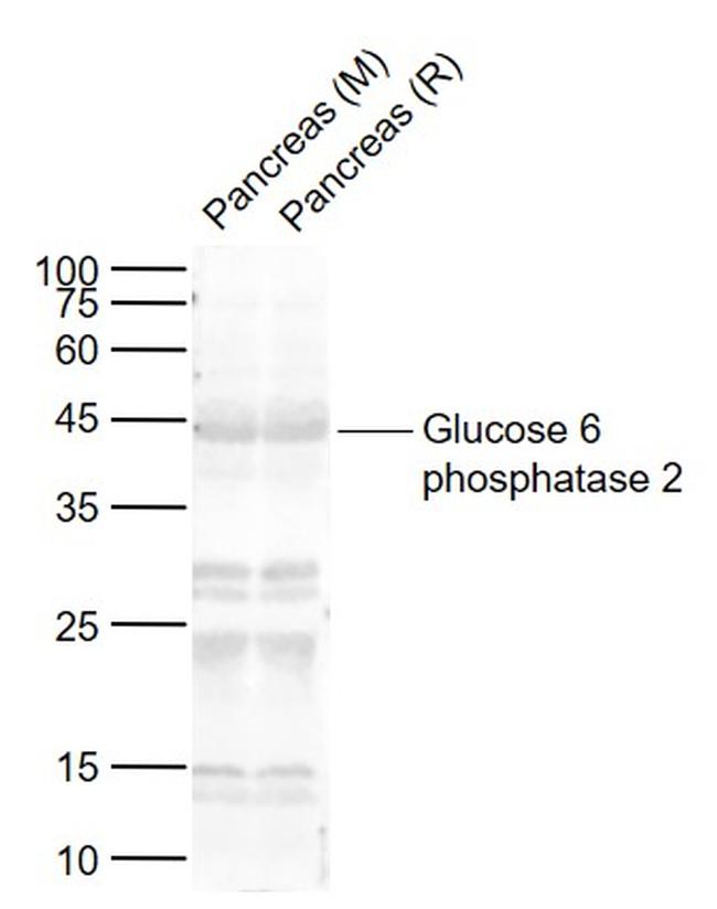Glucose 6 phosphatase 2 Antibody in Western Blot (WB)