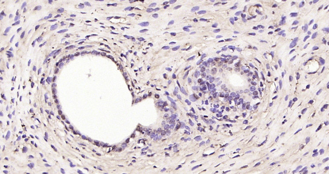 RSL1D1 Antibody in Immunohistochemistry (Paraffin) (IHC (P))