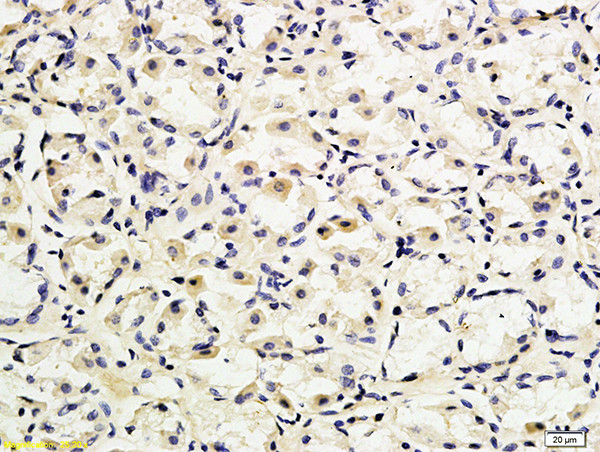 CD162 Antibody in Immunohistochemistry (Paraffin) (IHC (P))