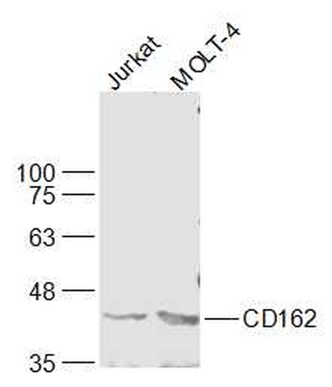 CD162 Antibody in Western Blot (WB)