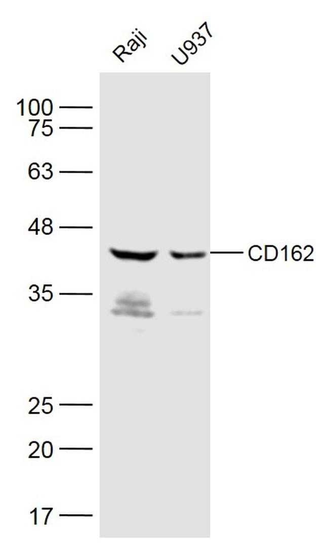 CD162 Antibody in Western Blot (WB)