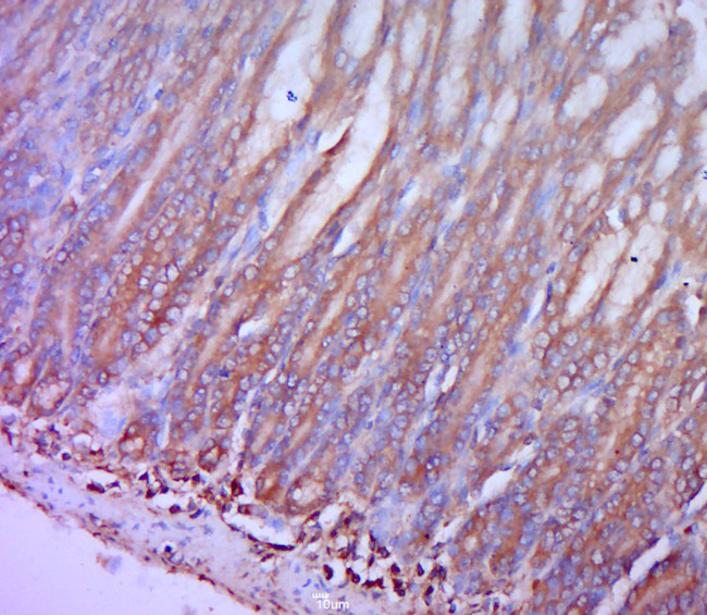 CCR2 Antibody in Immunohistochemistry (Paraffin) (IHC (P))