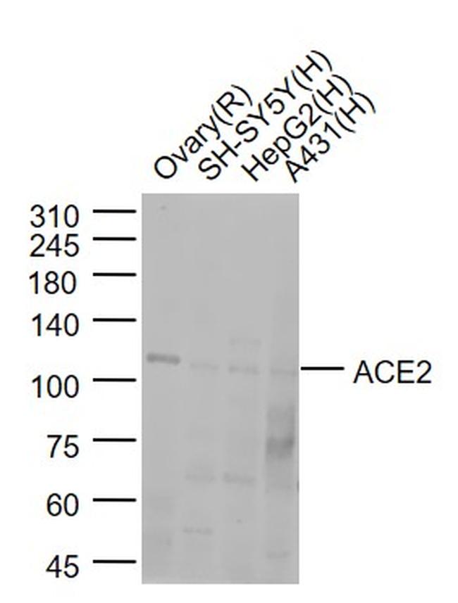 ACE2 Antibody in Western Blot (WB)