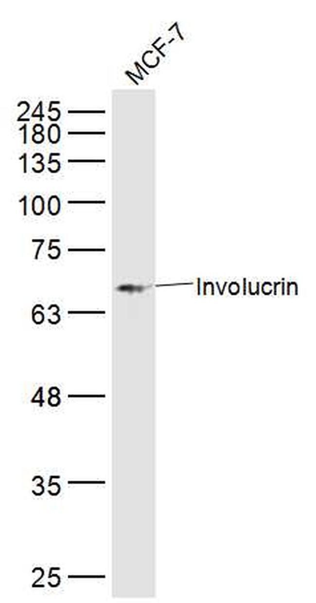 Involucrin Antibody in Western Blot (WB)