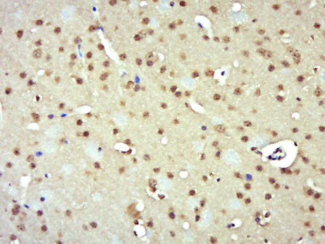 E2F1 Antibody in Immunohistochemistry (Paraffin) (IHC (P))